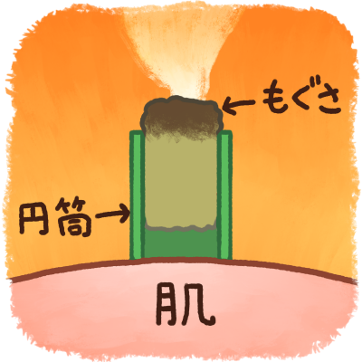 円筒灸で安心です。